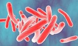 Non Tuberculous Mycobacteria (NTM) / MOTT